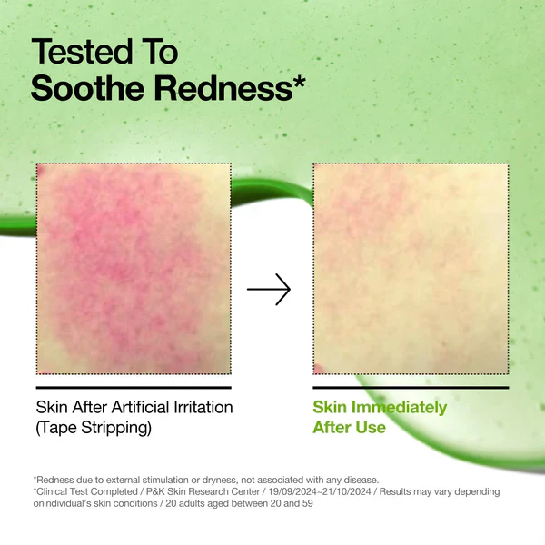 ANUA Azelaic Acid 10 Hyaluron Redness Soothing Serum 30ml - Image 4