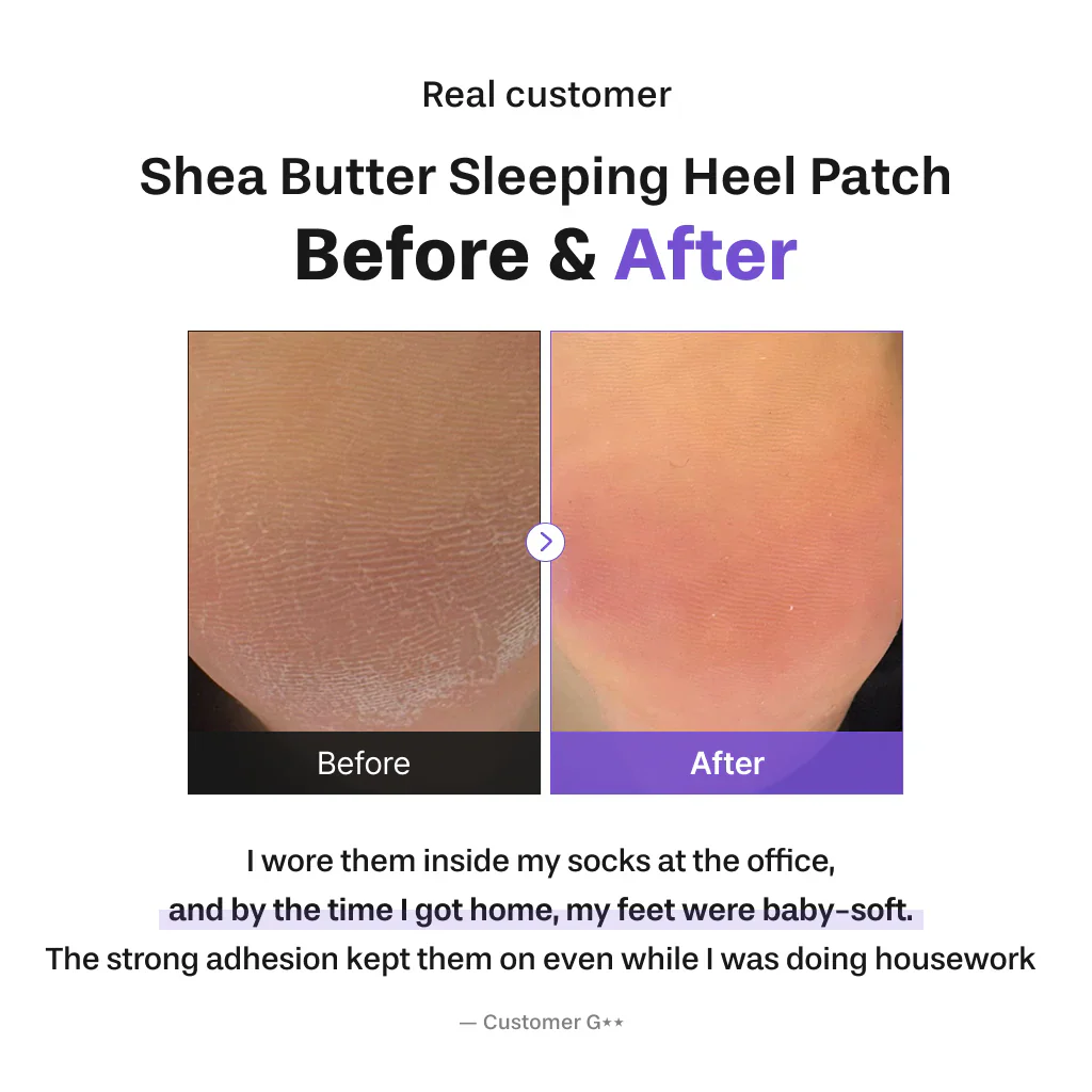BAREN Shea Butter Sleeping Heel Patch 10ea - Image 7