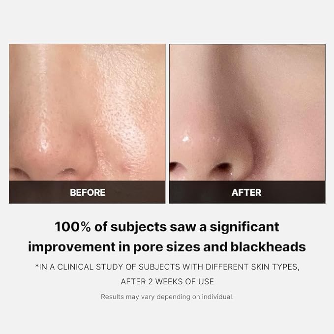 MEDICUBE Zero Pore Pad (70pcs) - Image 8