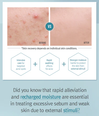 Pyunkang Yul ACNE Dressing Mask Pack - Image 6